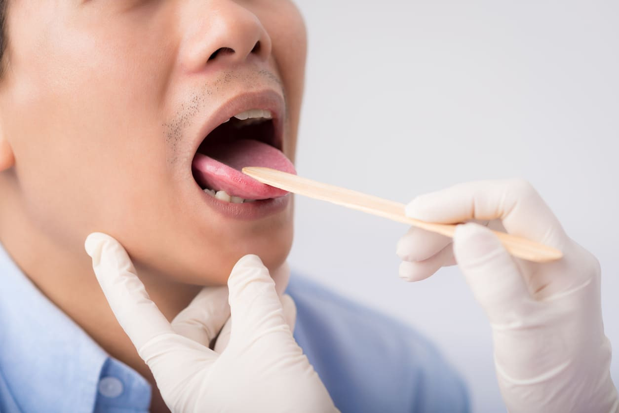 7 Cara Mengatasi Lidah Terasa Logam
